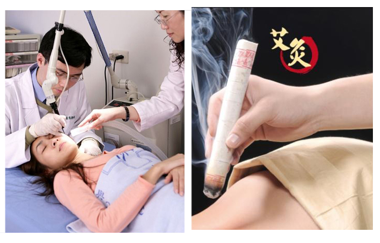 艾灸榴莲视频APP官网